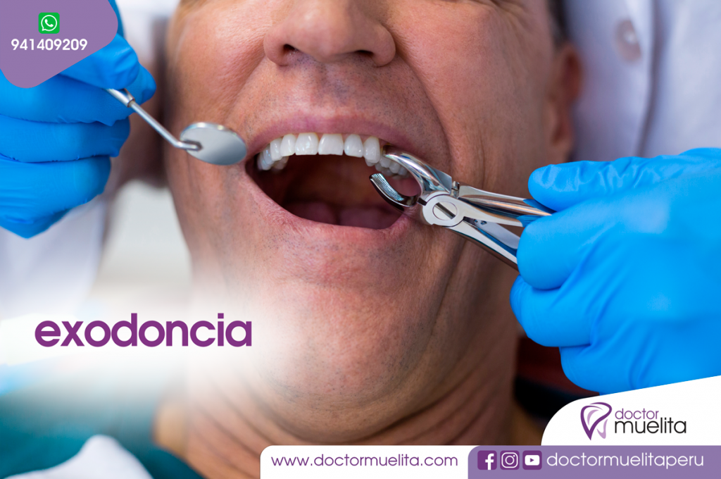 Exodoncia Clínica Doctor Muelita