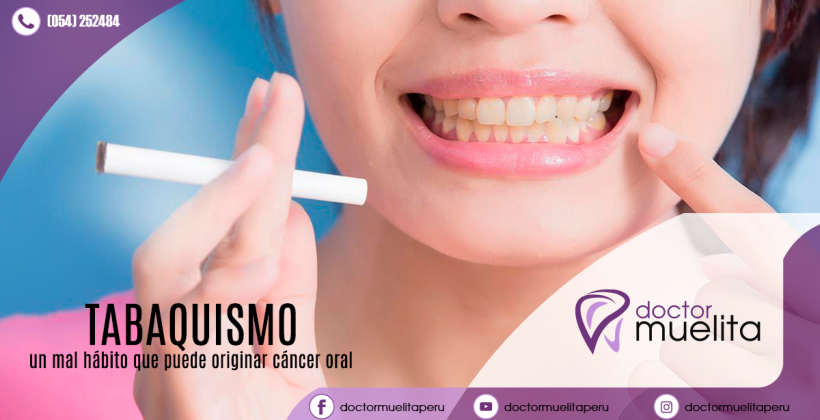 ¿Sabes el daño que le haces a tus dientes el fumar diariamente un cigarrillo? ¿Sabes el daño que le haces a tus dientes el fumar diariamente un cigarrillo?