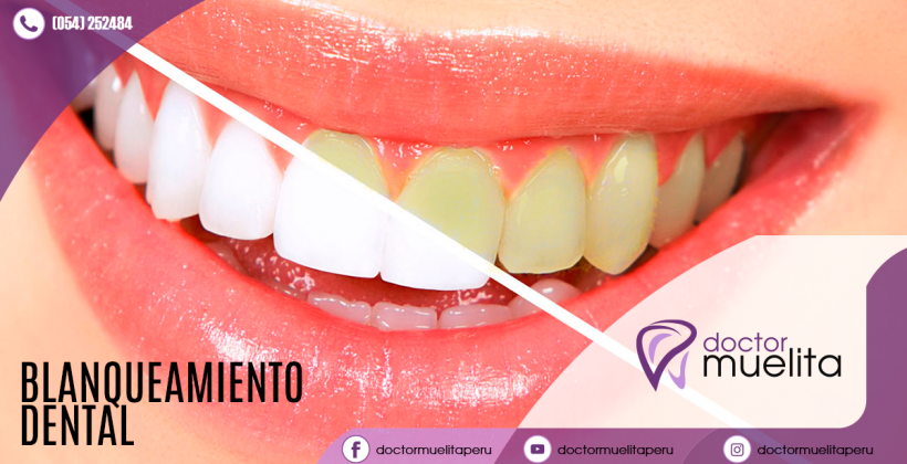 ¿Tienes los dientes amarillos? ¿Tienes los dientes amarillos?