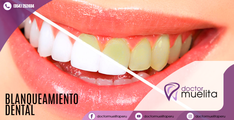 ¿Tienes los dientes amarillos?