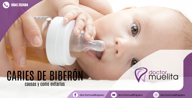 ¿Sabes qué son las caries de biberón? ¿Sabes qué son las caries de biberón?