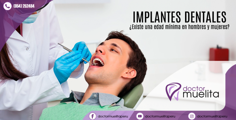 ¿Cuál es la edad mínima para colocar implantes dentales? ¿Cuál es la edad mínima para colocar implantes dentales?