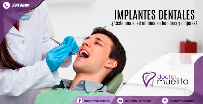 ¿Cuál es la edad mínima para colocar implantes dentales?