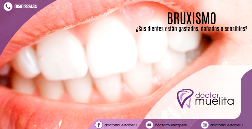 ¿Sus dientes rechinan o suenan como bisagras? ¿Sus dientes rechinan o suenan como bisagras?