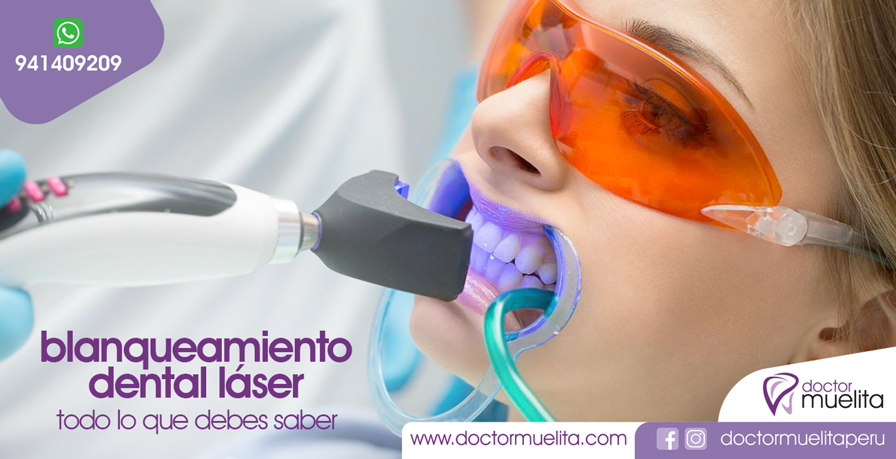 Todo lo que debes saber del BLANQUEAMIENTO DENTAL LÁSER Clínica
