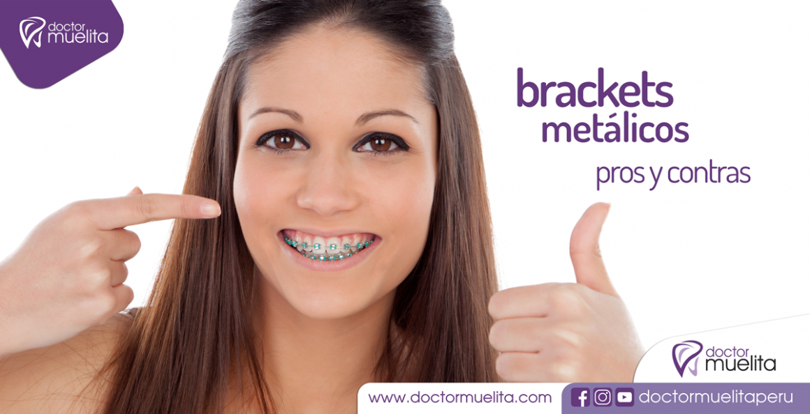 Conociendo los BRACKETS METÁLICOS Clínica Doctor Muelita