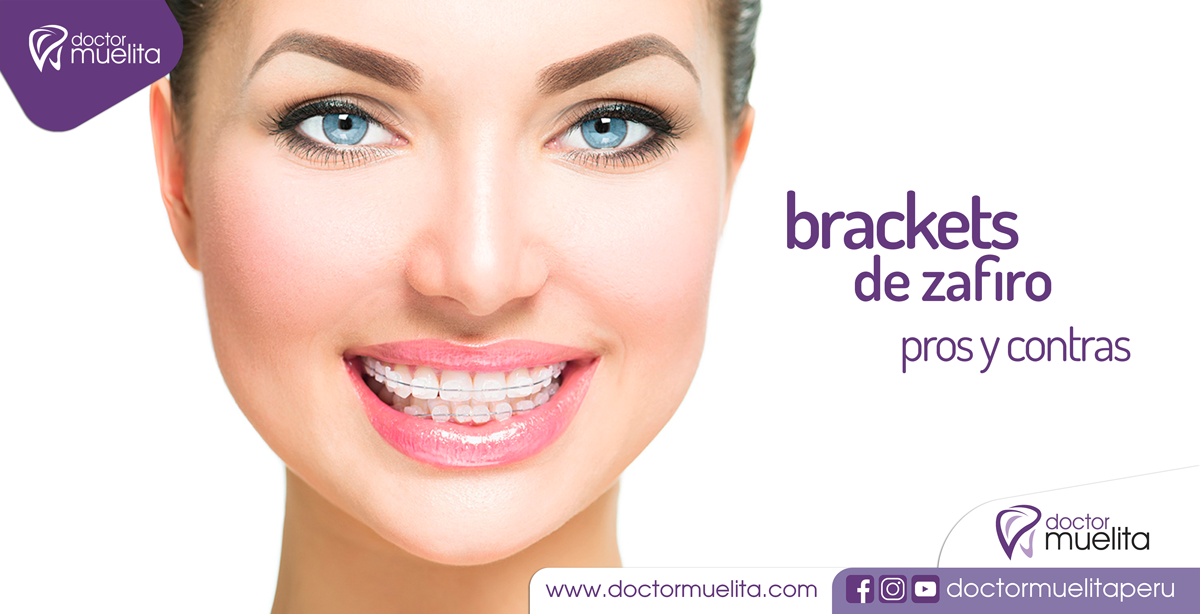 Conociendo los BRACKETS DE ZAFIRO Clínica Doctor Muelita