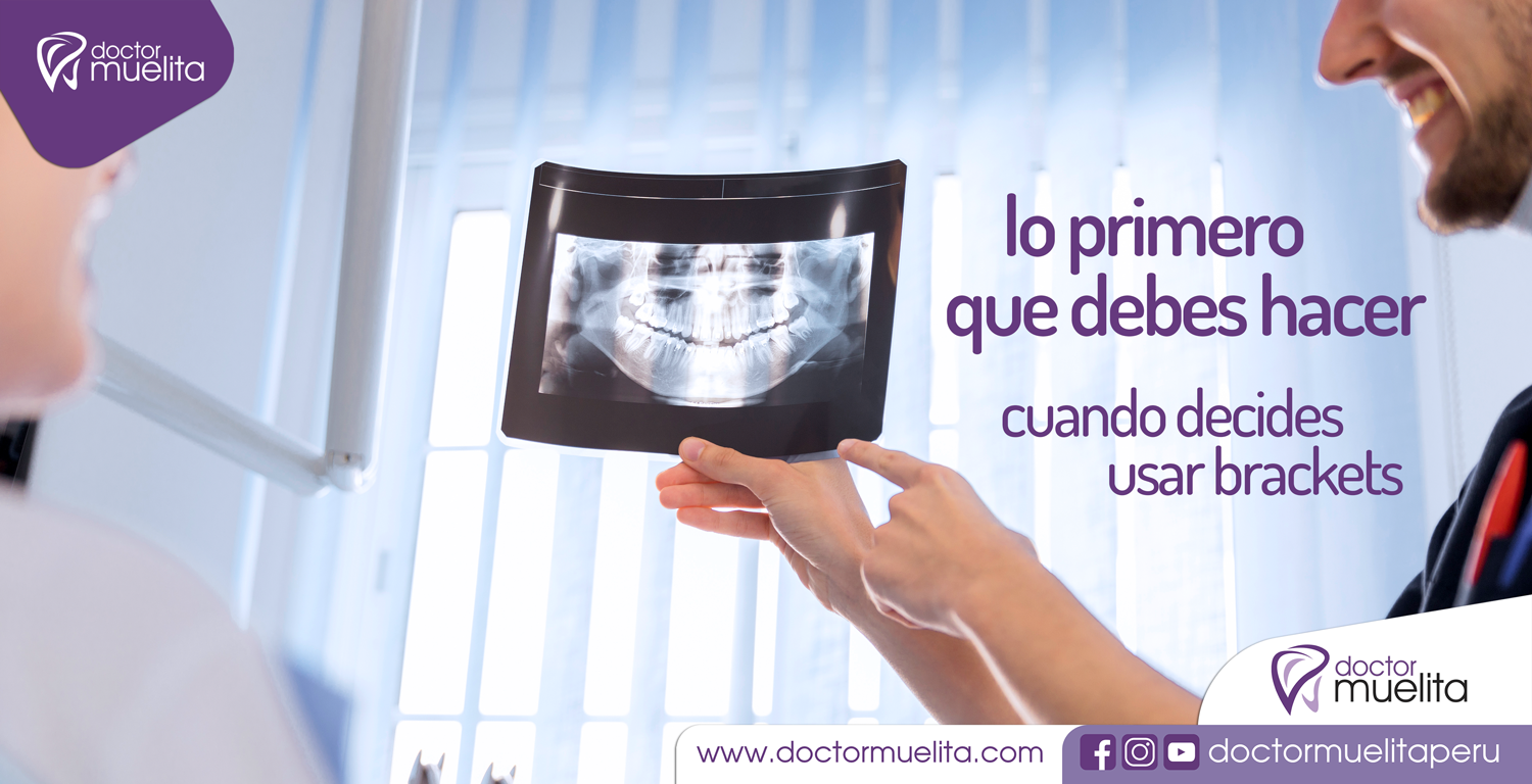 Lo primero que debes hacer cuando decides usar BRACKETS Doctor Muelita