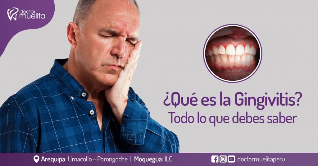 ¿Qué es la Gingivitis?, todo lo que debes saber Clínica Doctor Muelita