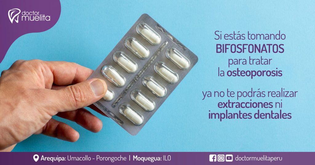 Si estás usando bifosfonatos para combatir la osteoporosis, no te ...