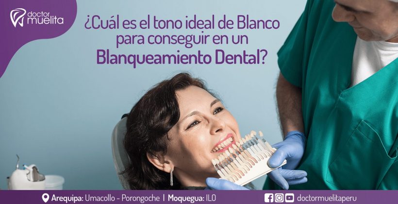 ¿Cuál es el tono ideal de Blanco para conseguir en un Blanqueamiento Dental?