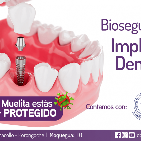 Bioseguridad en Implantes Dentales en Doctor Muelita