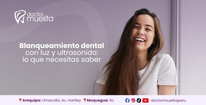 Blanqueamiento dental con luz y ultrasonido: lo que necesitas saber