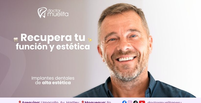Recupera tu función y estética con implantes dentales | Doctor Muelita 🦷